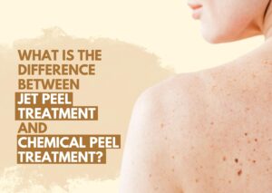 Difference between Jet Peel and Chemical Peels